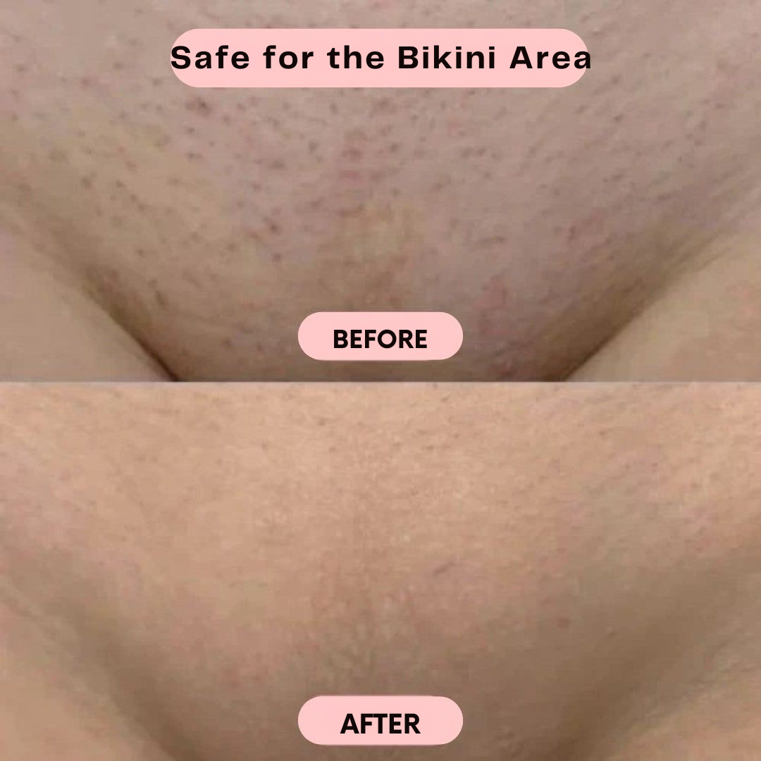 Rasoir électrique sans fil pour femme – tondeuse 2-en-1 pour utilisation à sec ou sous l’eau